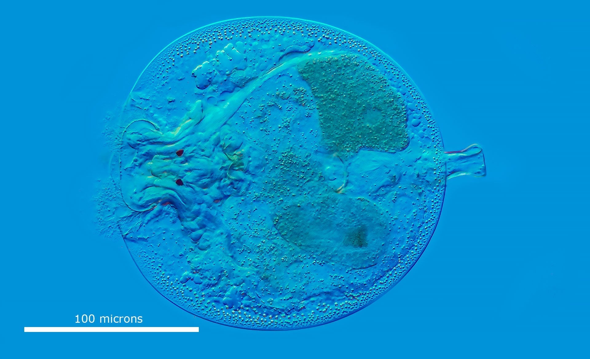 Microscopic viewing of Aquatic Invertebrates:  Ciliates, Rotifers, Cladocerans, Insects, Hydra, and Amoeba