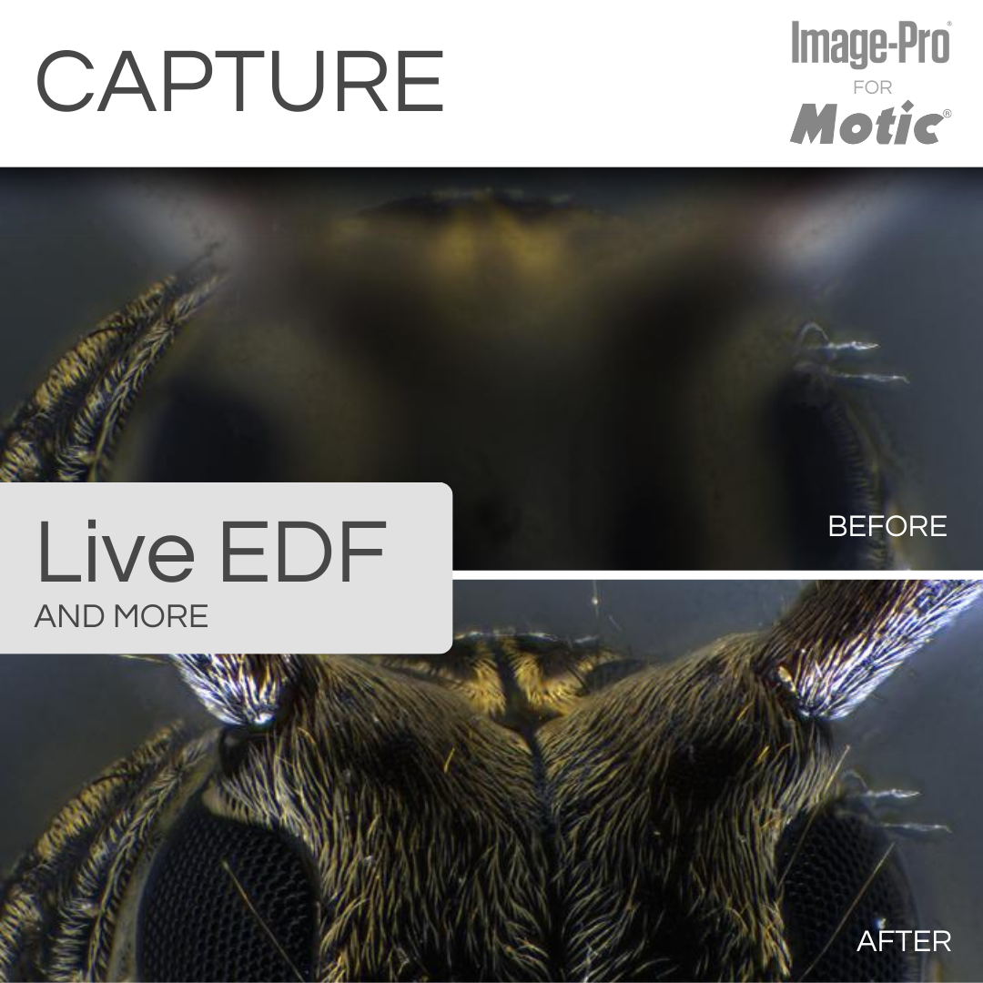 SM7-BIO &amp; Image-Pro® Analysis Package